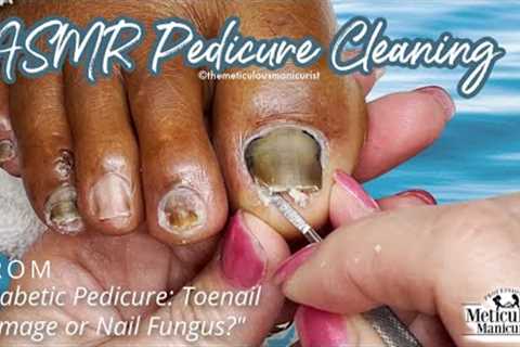 👣ASMR Pedicure Cleaning💆‍♀️Diabetic Pedicure: Toenail Damage or Nail Fungus?👣