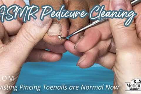 👣ASMR Pedicure Cleaning💆‍♀️Twisting Pincing Toenails are Normal Now👣