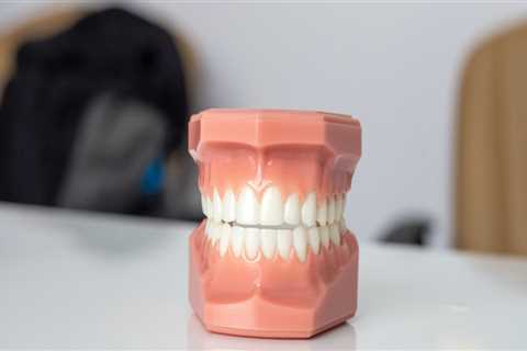 Can Dentures Look Like Real Teeth