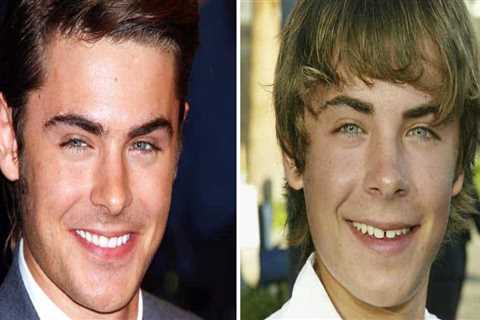 How Do Celebrities Whiten their Teeth