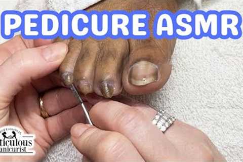 👣ASMR Pedicure Cleaning💆‍♀️Twisting, Turning, and Curling Toenails Pedicure Tutorial👣