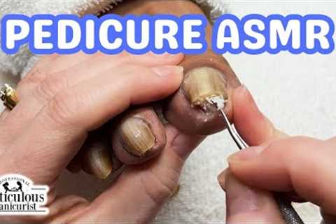 👣ASMR Pedicure Cleaning💆‍♀️Pedicure Tutorial: How to Relieve Pain in Your Toenails👣